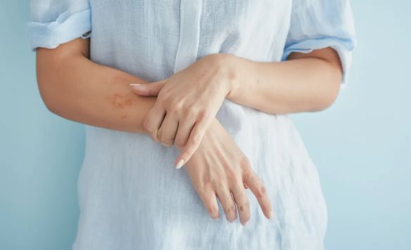 Девушка с аутоагрессией стоит и трогает свои руки